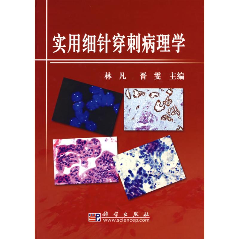 实用细针穿刺病理学 林凡,晋雯 主编 著作 内科学生活 新华书店正版图书籍 科学出版社 文轩网|ruв категории книги/журнал/газета, медицинского здравоохранения, основы медицины - от Buy2taobao.com для оказания профессиональной услуги покупки агента Taobao