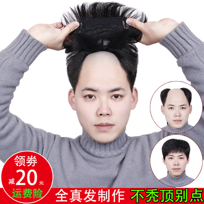 男士补发块翻盖假发接片发套手织头顶遮白全真发秃顶隐形无痕眉俏