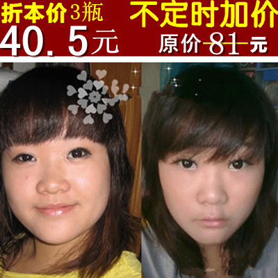【瘦<em>咬肌</em>霜】_<em>女人我最大</em> 瘦<em>咬肌</em>_瘦<em>咬肌</em>的按