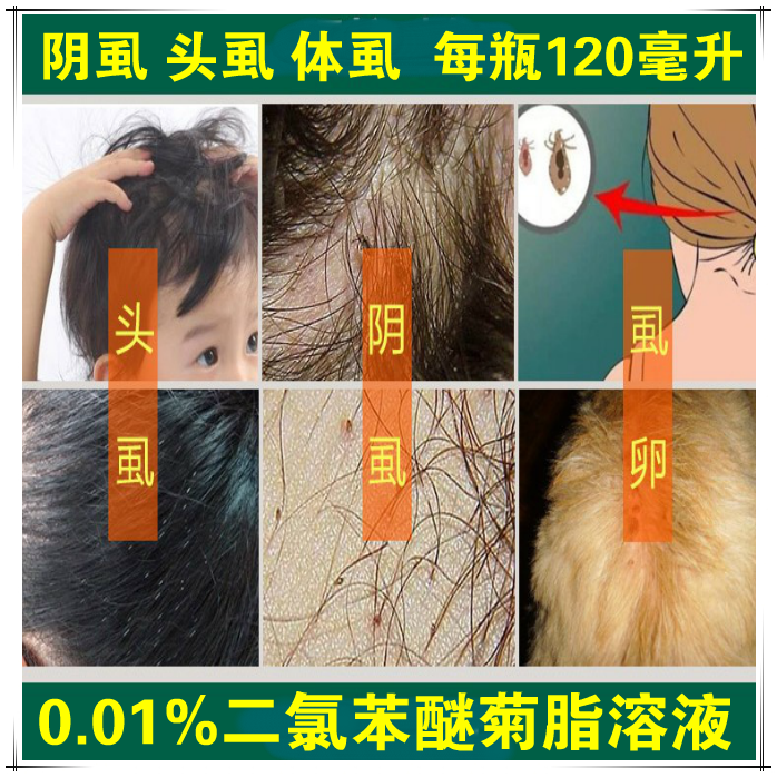 阴虱0.01%二氯苯醚菊脂酯溶液阴虱净灵乐喷雾剂 虱虫一扫光百步酊在类目 洗护清洁剂/卫生巾/纸/香薰, 洗发沐浴/个人清洁, 身体护理, 其它身体护理产品中 - 来自Buy2taobao.com提供专业的淘宝代购服务