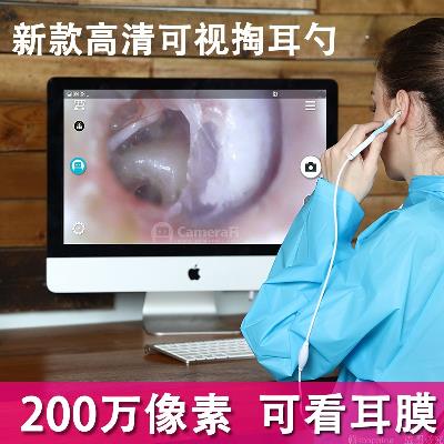 可视挖耳神勺器掏耳带灯0万掏耳勺洁内窥视高清20镜可发光耳朵清|msdalam kategori keluarga/Alat Pembersihan peribadi, Peralatan pembersihan penjagaan diri, Ershao - dari Buy2taobao.com untuk memberikan perkhidmatan ejen Taobao profesional membeli