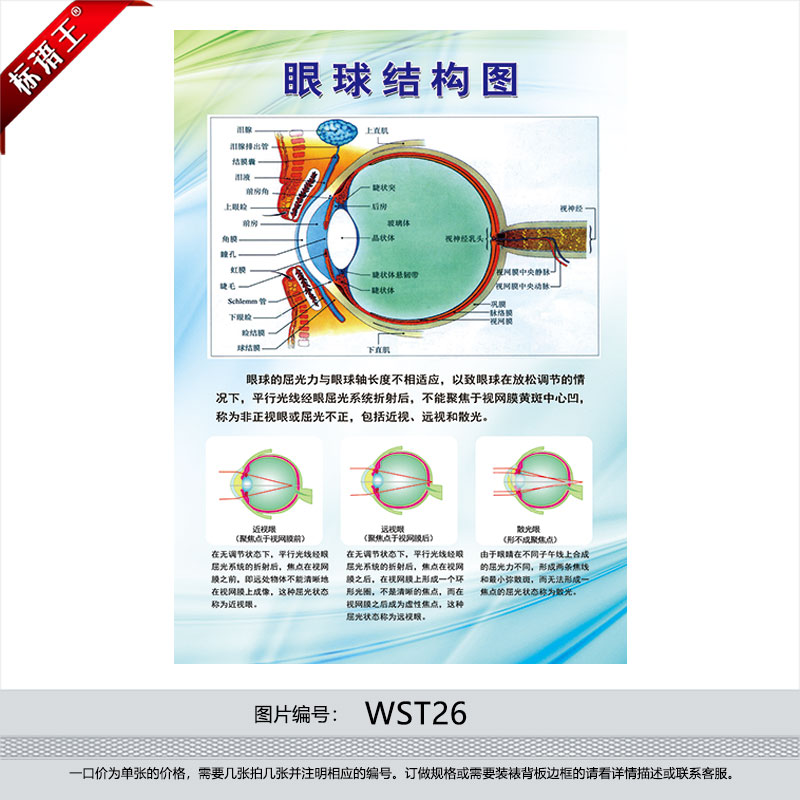 眼球结构图示意图宣传画海报挂图保护眼晴预防近视宣传贴画wst26