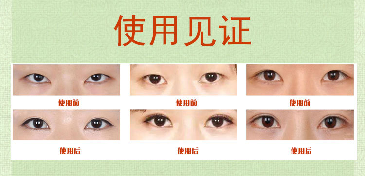 小眼睛变大神器男士双眼皮开眼角双眼皮按摩正品在类目 美容护肤/美体/精油, 精油芳疗, 单方精油中 - 来自Buy2taobao.com提供专业的淘宝代购服务