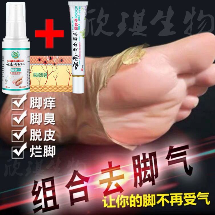 治療脚氣脚臭脚汗出汗去根药膏喷剂泡脚药包脱皮克星杀菌外用神器在类目 本地化生活服务, 健康服务, 足浴/洗浴/按摩中 - 来自Buy2taobao.com提供专业的淘宝代购服务