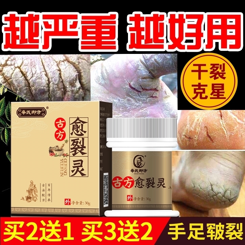 Chapped Foot Heel Drying Gap Chapped Skin care Cream Shouyangin the Care cleaners/Sanitary napkins/Paper/Aromatherapy , Shampoo bath/Personal cleanliness , Body Care , Hand Cream category - from Buy2taobao.com to provide professional Taobao agent buy service