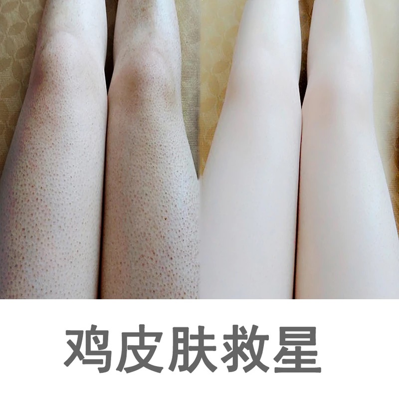 去鸡皮肤疙瘩毛囊角质沐浴露全身女士去背后痘痘死皮男洗澡除螨乳在类目 美容护肤/美体/精油, 身体护理(新), 沐浴露中 - 来自Buy2taobao.com提供专业的淘宝代购服务