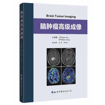 西安世图:脑肿瘤高级成像|msdalam kategori buku/Magazine/akhbar, Kesihatan perubatan, ubat lain - dari Buy2taobao.com untuk memberikan perkhidmatan ejen Taobao profesional membeli