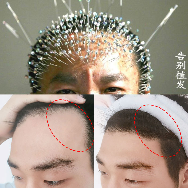 生姜洗发水,小红书达人推荐】 头发变密变多变长 自然生长速度|msdalam kategori Penjagaan rambut/rambut palsu, Syampu Rambut (baru), syampu - dari Buy2taobao.com untuk memberikan perkhidmatan ejen Taobao profesional membeli