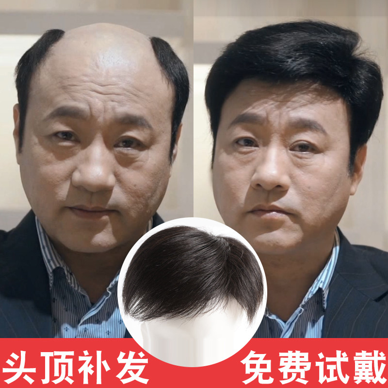 假发男头顶补发块男士真发隐形无痕秃顶补发片地中海遮白发毛寸头在类目 美发护发/假发, 假发, 整顶假发中 - 来自Buy2taobao.com提供专业的淘宝代购服务