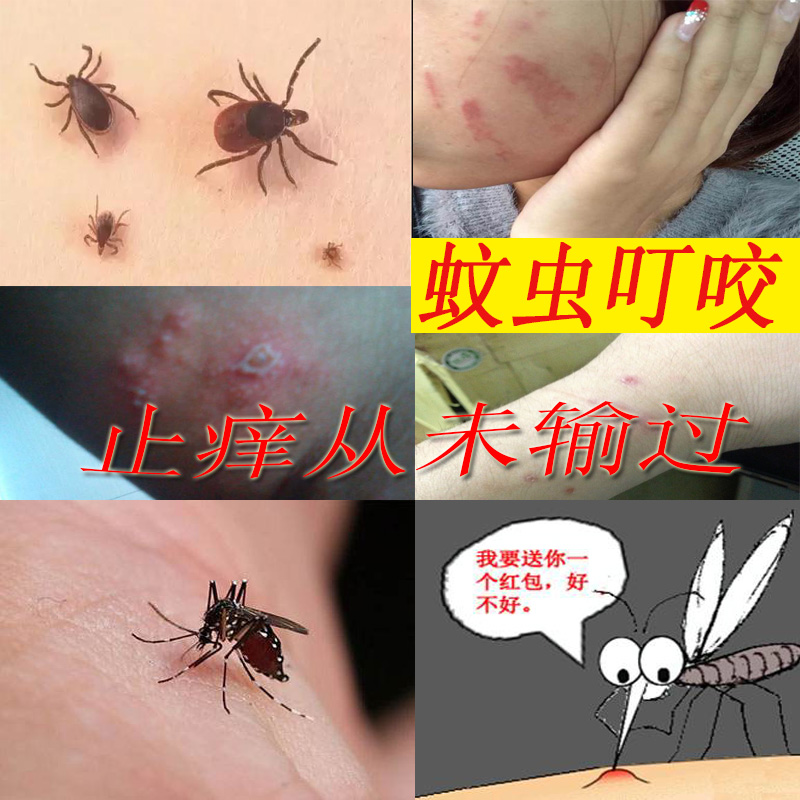 蚊子蚊虫叮咬止痒消肿膏泰国青草膏蚊虫叮咬药膏婴儿蚊虫叮咬药膏在类目 尿片/洗护/喂哺/推车床, 驱蚊退烧用品, 止痒膏中 - 来自Buy2taobao.com提供专业的淘宝代购服务