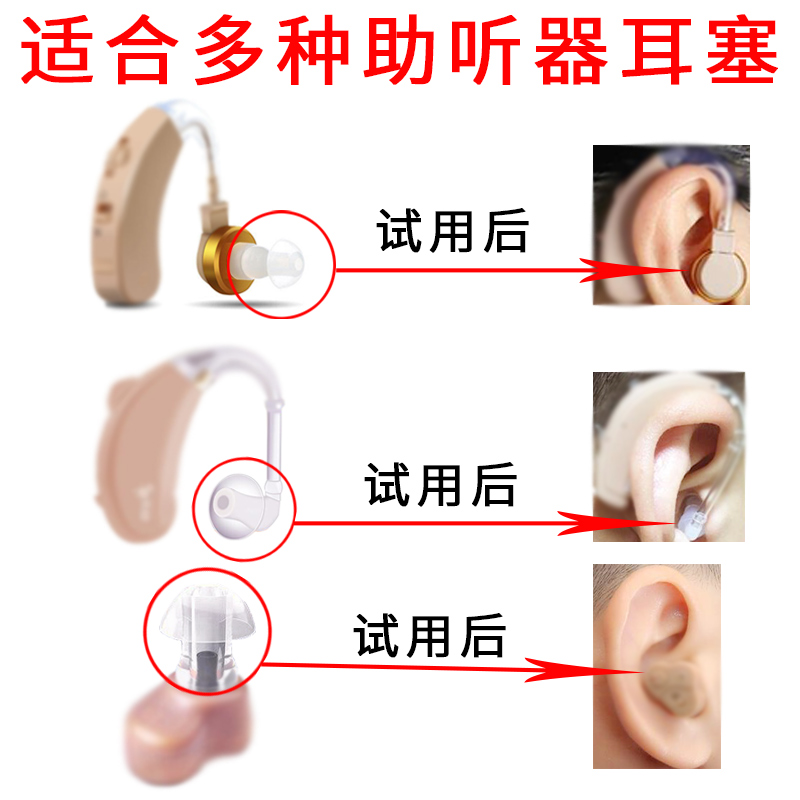 国产进口助听器配件软耳塞 硅胶耳塞软塞耳堵耳帽助听器蘑菇头大在类目 3C数码配件, MP3/MP4配件, 耳机配件中 - 来自Buy2taobao.com提供专业的淘宝代购服务
