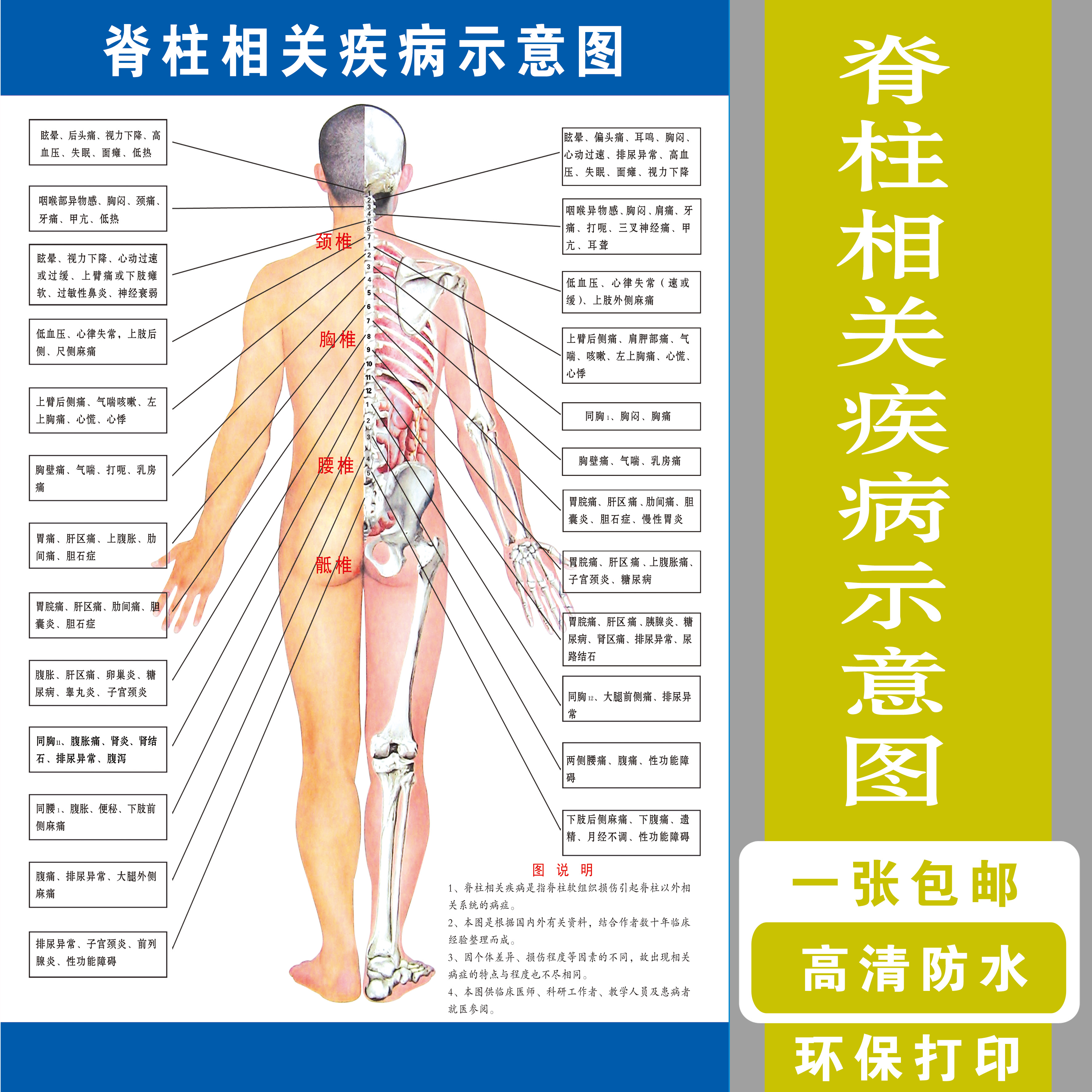 Spine Related disease Schematic diagram TCM Pathology The reason Chart Poster posterin the Personalized custom/Design Services/DIY , Daily/Decorative custom , Photo/Poster printing category - from Buy2taobao.com to provide professional Taobao agent buy service