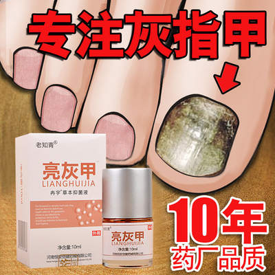 灰指甲专用液软甲膏贴去除增厚灰甲净外用药正品冰醋酸抑菌液