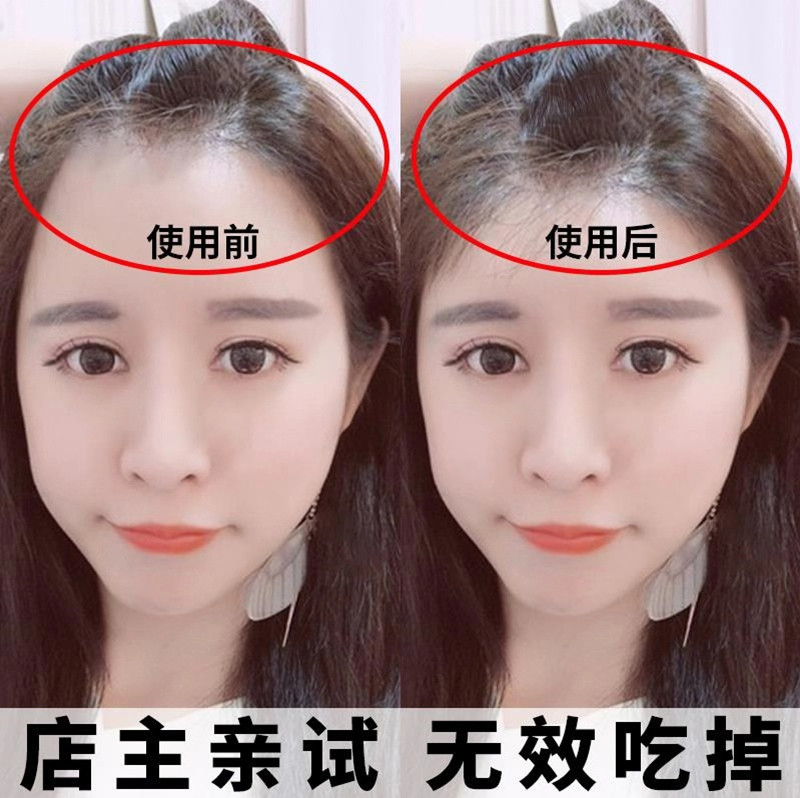 日本原裝進口樂洗喜力絲生發防脫發育發液宜黑發萊雅官網正品在類目 美髮護髮/假髮, 洗髮護髮(新), 洗髮水中 - 來自Buy2taobao.com提供專業的淘寶代購服務