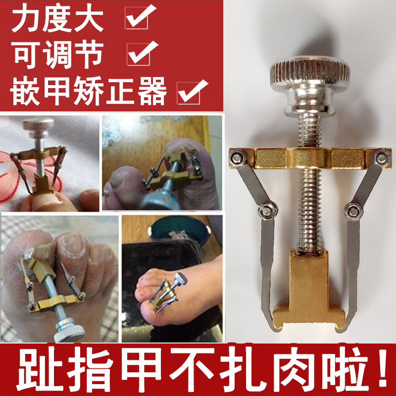 偏指甲矫正器甲沟神器炎内嵌外矫正脚趾甲嵌甲矫正器手指甲修正器在类目 家庭/个人清洁工具, 个人洗护清洁用具, 指甲刀/指甲钳, 美甲/修甲套装中 - 来自Buy2taobao.com提供专业的淘宝代购服务