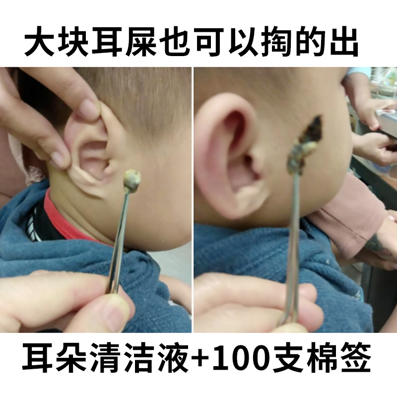 掏耳神器家用兒童嬰兒寶寶成人扣耳勺棉簽套裝油耳朵耳屎采耳大師在類目 家庭/個人清潔工具, 個人洗護清潔用具, 耳勺中 - 來自Buy2taobao.com提供專業的淘寶代購服務