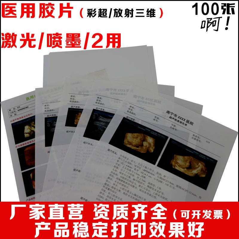 醫用膠片超聲B超彩超報告打印紙A4噴墨激光彩色16K瓷白幹式100張在類目 辦公設備/耗材/相關服務, 其它耗材, 其它中 - 來自Buy2taobao.com提供專業的淘寶代購服務