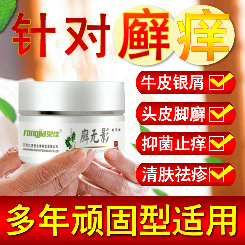 头皮癣牛皮藓银屑癣专用软膏草本癣痒净股癣外用手癣气泡止痒药膏在类目 OTC药品/医疗器械/计生用品, 保健用品, 皮肤消毒护理(消)中 - 来自Buy2taobao.com提供专业的淘宝代购服务