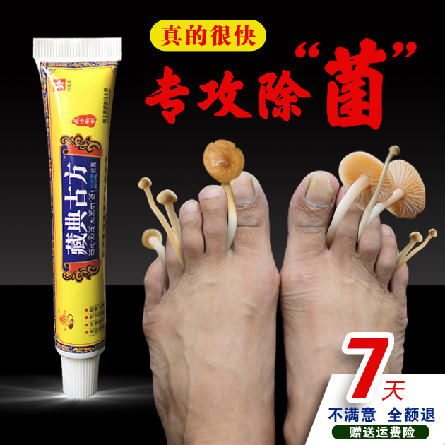 藏典古方手腳癢起小水泡過敏皮膚蚊子叮咬止癢膏抑菌買壹送壹同款在類目 尿片/洗護/餵哺/推車牀, 驅蚊退燒用品, 止癢膏中 - 來自Buy2taobao.com提供專業的淘寶代購服務