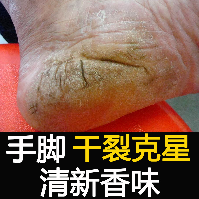 泰国香蕉膏进口防裂膏修复手脚干裂防手裂脚裂