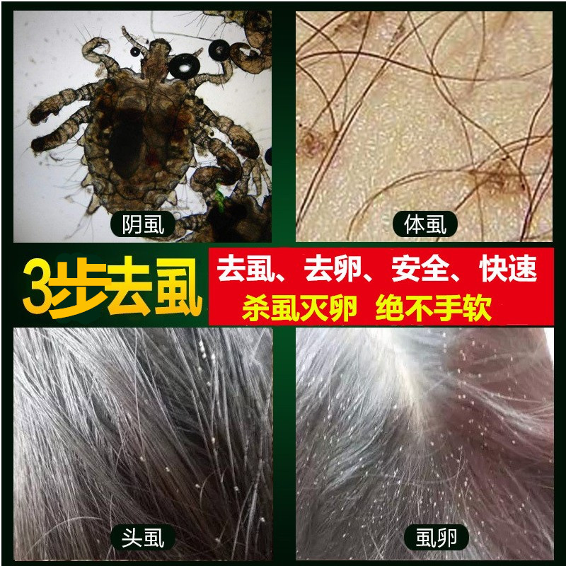 阴虱净儿童成人头虱喷剂奇痒阴毛去虱虫虱子卵一扫光正品百部酊药在类目 洗护清洁剂/卫生巾/纸/香薰, 驱虫用品, 灭鼠/杀虫剂中 - 来自Buy2taobao.com提供专业的淘宝代购服务