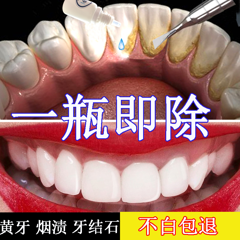 清洁神器牙齿家用牙渍牙石工具溶解牙结石去除器洗牙清理牙垢清除在类目 洗护清洁剂/卫生巾/纸/香薰, 洗发沐浴/个人清洁, 口腔护理, 牙刷/口腔清洁工具中 - 来自Buy2taobao.com提供专业的淘宝代购服务