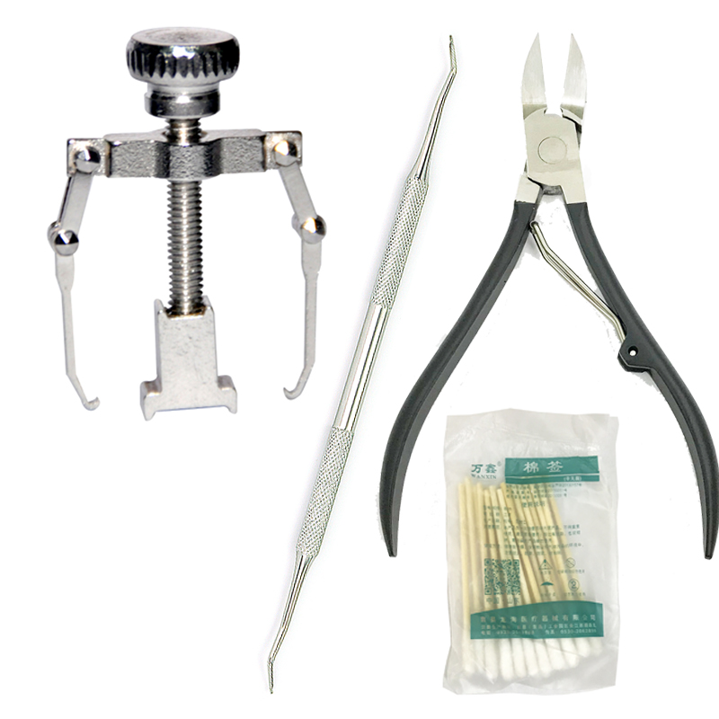 Ingrown Toenails Orthotic device Toe Toe nail Correction Cutlery Ingrown Toenails Special tool Embeddedin the Family/Personal Cleaning Tools , Personal care cleaning appliances , Nail clippers/Nail clippers , Nail/Manicure Set category - from Buy2taobao.com to provide professional Taobao agent buy service
