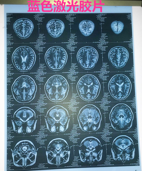 蓝色激光 8*10医用彩色激光防水胶片 X光胶片CR DR胶片 双面打印在类目 办公设备/耗材/相关服务, 办公用纸, 相片纸中 - 来自Buy2taobao.com提供专业的淘宝代购服务