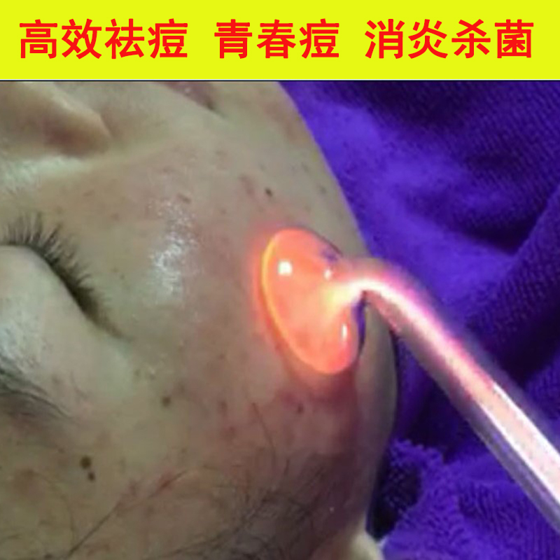 美容院祛痘美容仪器家用暗疮皮肤消炎杀菌粉刺皮肤红肿生发养发|msdalam kategori Penjagaan diri/kesihatan/peralatan urut, Kosmetologi/alat bantuan badan, lain Beauty/alat badan - dari Buy2taobao.com untuk memberikan perkhidmatan ejen Taobao profesional membeli