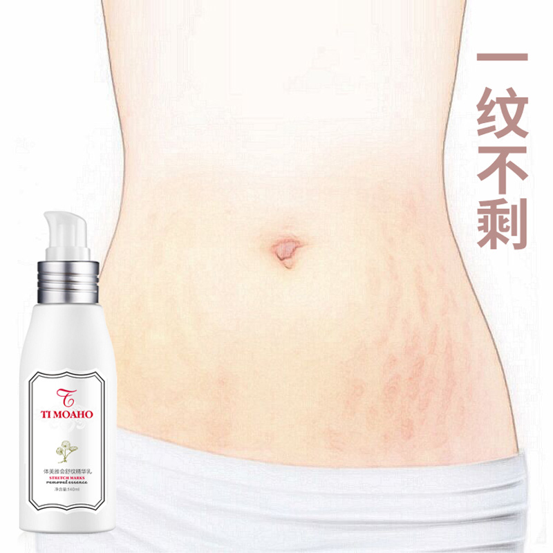 去妊娠紋修複霜産後專用去妊辰紋小春淡化袪肥胖紋生長紋非橄榄油在類目 孕婦裝/孕產婦用品/營養, 孕產婦護膚/洗護/祛紋, 妊娠紋護理中 - 來自Buy2taobao.com提供專業的淘寶代購服務
