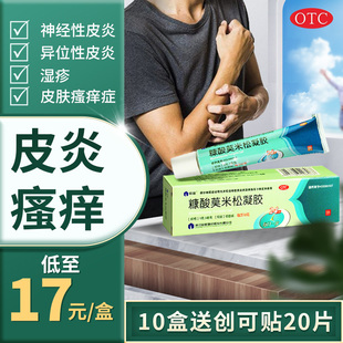 as low as 18 xianju mometasone furoate gel eczema non-ointment neurodermatitis itchy skin non-