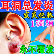 耳洞护理消炎液治增生疙瘩防耳朵痒发炎红肿流脓止痒抑菌清洁