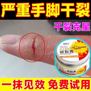 专治手裂的药膏防皲裂防裂膏专用手指开裂脱皮手干燥粗糙脱皮修复