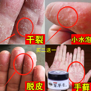 手癣膏手足癣湿疹止痒真菌感染治疗汗，疱疹脱皮干裂水泡藓药膏手气