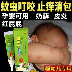 可爱儿童抑菌膏室内防皮炎专用止痒凝膏植物涂抹婴儿宝宝湿疹止痒