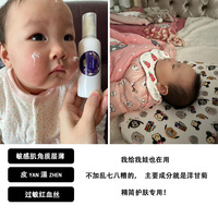 洋甘菊乳液，抗敏乳，角质层红血丝修复乳，过敏修复补水保湿