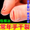 100%修复治手裂的药膏防干裂手指开裂脚后跟裂口干燥粗糙防裂