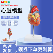 人体器官心脏模型心血管b超彩超自然大心脏内脏解剖医学教学用具