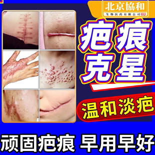祛疤膏去疤痕灵巴修复膏除疤手术烫伤疤痕淡化剖腹产非日本进口DZ