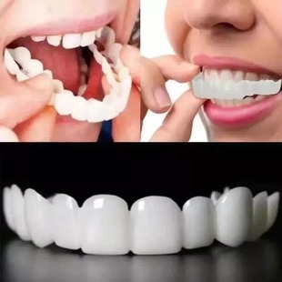 牙缝隙大假牙套牙仿真假，牙齿牙缝填充神器门，牙缝矫正器大龅牙牙套