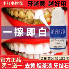 牙斑净牙菌斑牙齿美白速效黄牙专业去除牙烟渍神器氟斑牙变白