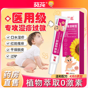 婴宝湿疹婴儿专用宝宝湿疹膏止痒保湿面霜无激素儿童口水疹ts