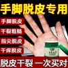 手脱皮严重脱皮专用治疗真菌，感染手心手脚，干裂起皮掉皮脱皮药膏
