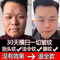 男提拉去皱纹除皱抗衰老面霜护肤品去去抬头纹紧致抗皱男士皱