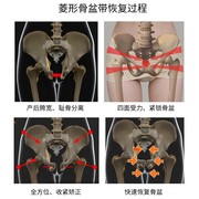 骨盆修复带前倾矫正产后收腹收盆骨修复带假胯宽矫正仪盘收胯神器