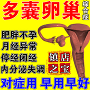 多囊卵巢综合征调理月经不调子宫，内膜调理增厚促排卵助备孕泡脚包
