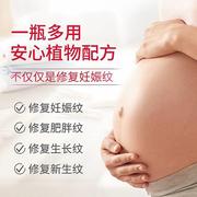 去肥胖纹生长纹消除大腿学生男女修复霜膏祛妊娠纹产後纹淡化