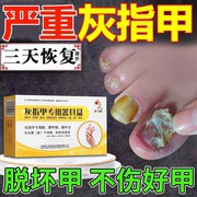 灰指甲特亮甲效膏药，贴水专用真菌，感染灰指甲一滴抑菌净