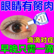 拨云锭眼水叶黄素滴眼液，缓解疲劳干涩视力模糊滴眼水去红血丝眼疲