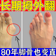 大指姆外翻矫正器可穿鞋贴脚指脚骨突出矫正器防磨脚男女足用